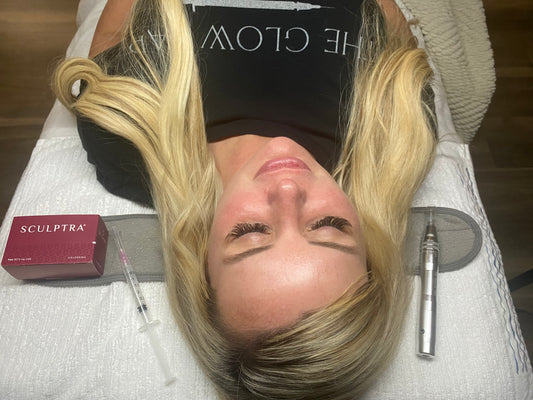 Full face Microneedling + Sculptra